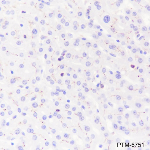 Anti-Glypican 3 Rabbit mAb