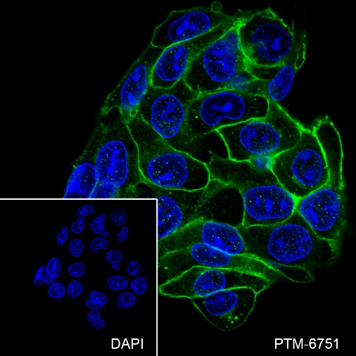 Anti-Glypican 3 Rabbit mAb