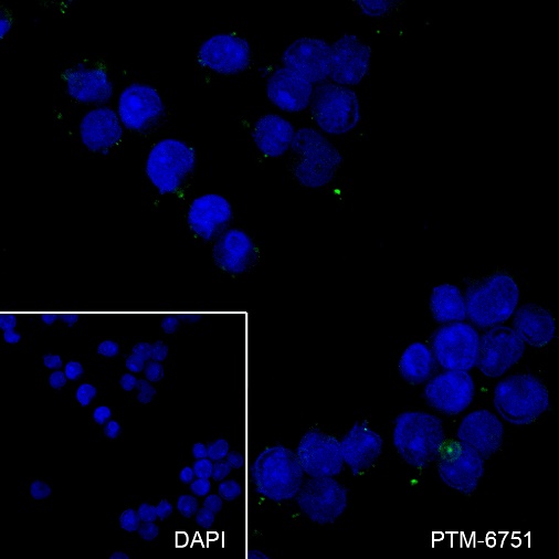 Anti-Glypican 3 Rabbit mAb