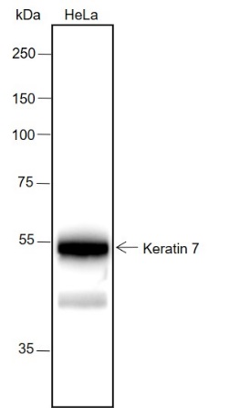 Anti-Keratin 7 Rabbit mAb