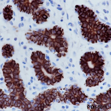 Anti-Keratin 7 Rabbit mAb
