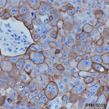 Anti-Keratin 7 Rabbit mAb