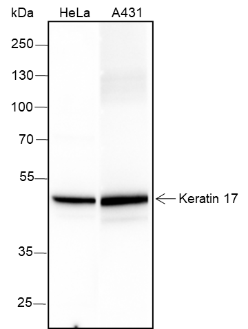 Anti-Keratin 17 Rabbit mAb