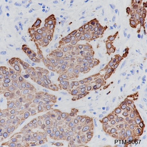 Anti-Keratin 17 Rabbit mAb