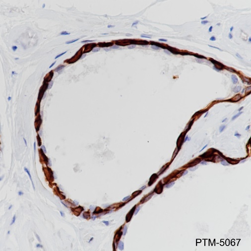 Anti-Keratin 17 Rabbit mAb