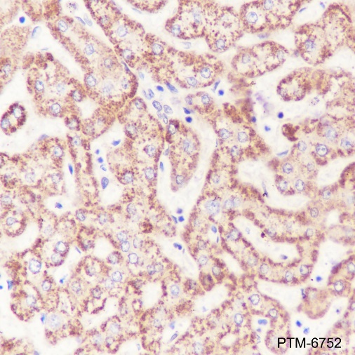 Anti-OTC Mouse mAb