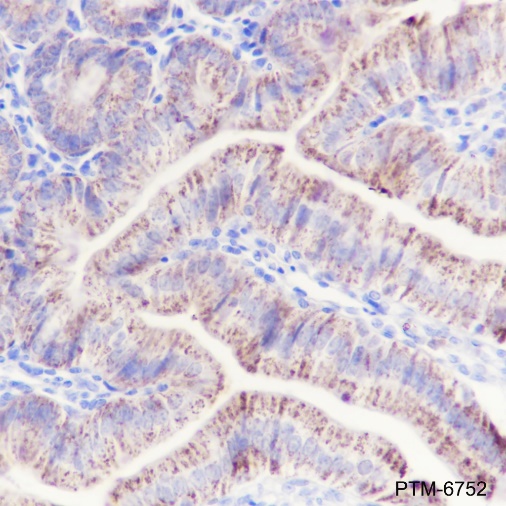 Anti-OTC Mouse mAb