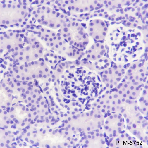 Anti-OTC Mouse mAb