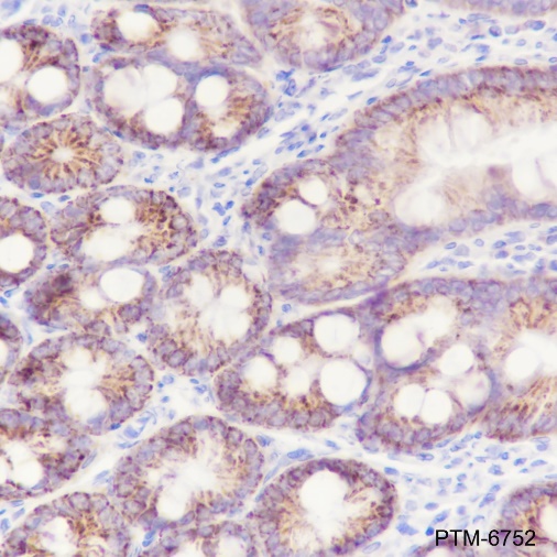 Anti-OTC Mouse mAb
