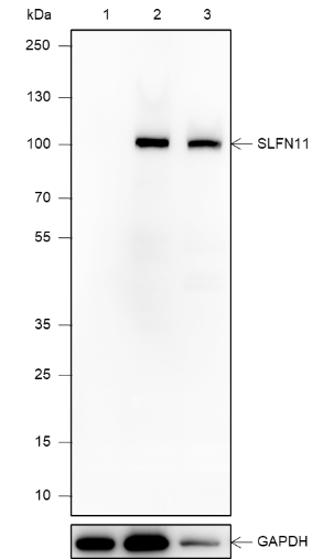 Anti-SLFN11 Rabbit mAb