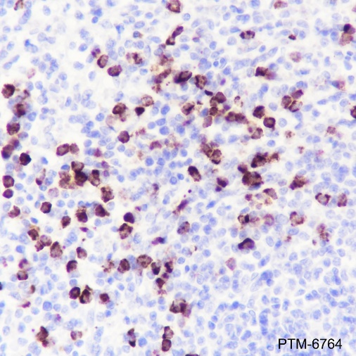 Anti-MMP8 Rabbit mAb