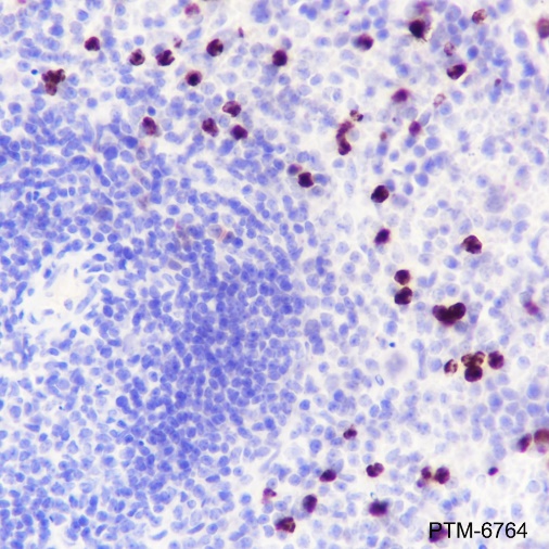 Anti-MMP8 Rabbit mAb