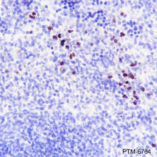 Anti-MMP8 Rabbit mAb