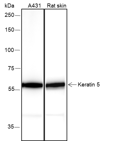 Anti-Keratin 5 Rabbit mAb