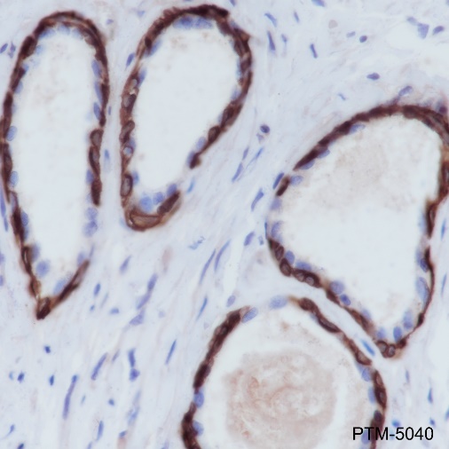 Anti-Keratin 5 Rabbit mAb