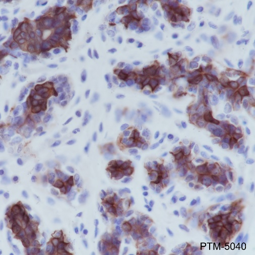 Anti-Keratin 5 Rabbit mAb
