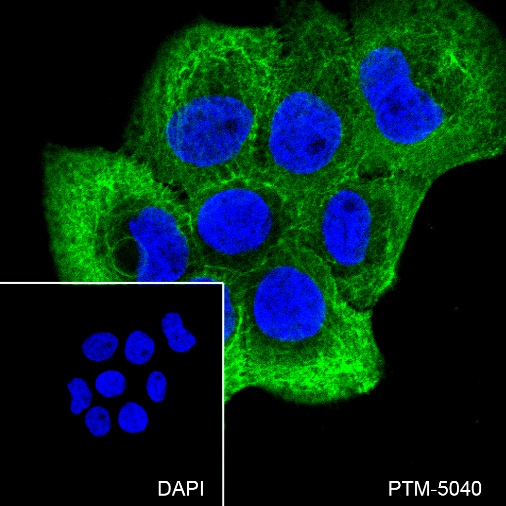 Anti-Keratin 5 Rabbit mAb