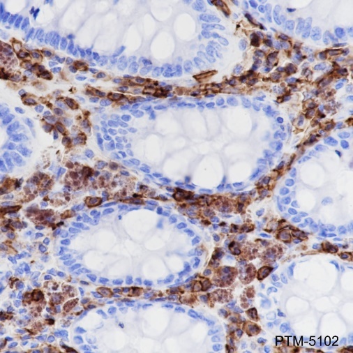 Anti-CD38 Rabbit mAb
