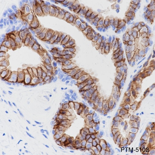 Anti-CD38 Rabbit mAb