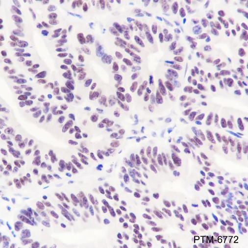 Anti-CTCF Mouse mAb
