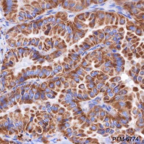 Anti-Citrate Synthase Mouse mAb