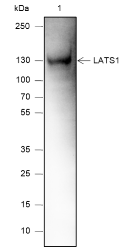Anti-LATS1 Rabbit mAb