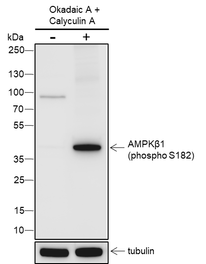Anti-Phospho-AMPK beta 1 (Ser182) Rabbit pAb