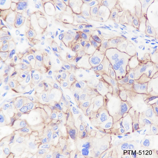 Anti-CD47 Rabbit mAb