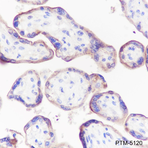 Anti-CD47 Rabbit mAb