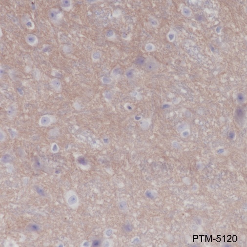 Anti-CD47 Rabbit mAb