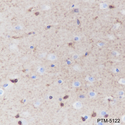 Anti-S100B Rabbit mAb