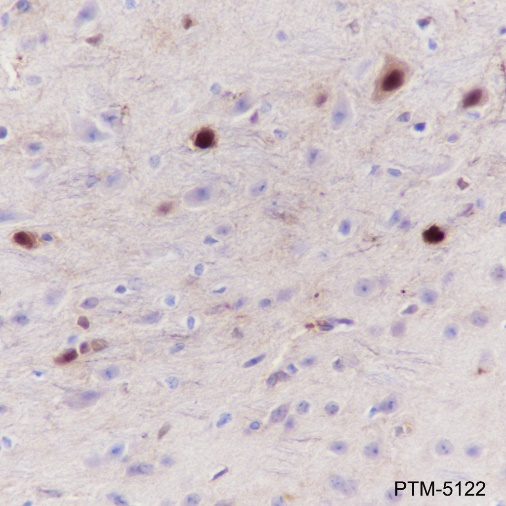 Anti-S100B Rabbit mAb