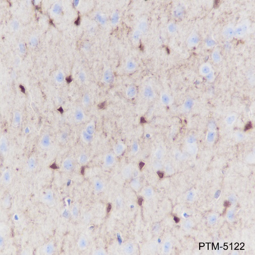 Anti-S100B Rabbit mAb