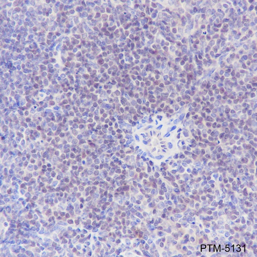 Anti-SATB1 Rabbit mAb