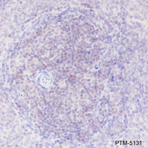 Anti-SATB1 Rabbit mAb