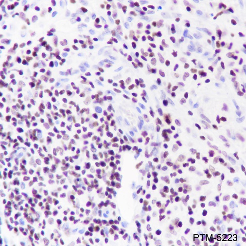 Anti-IKAROS Rabbit mAb
