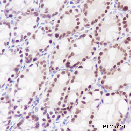 Anti-Ku80 Rabbit mAb