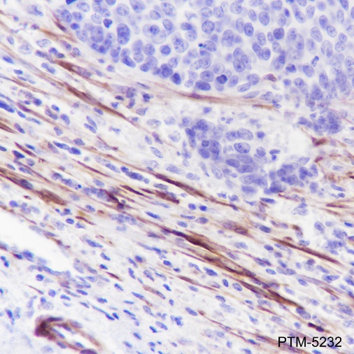 Anti-Calponin 1 Rabbit mAb
