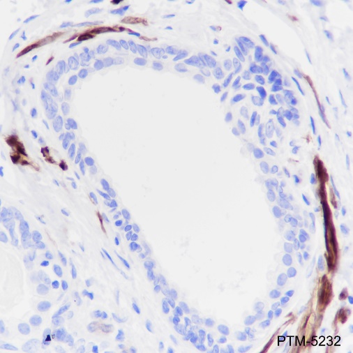 Anti-Calponin 1 Rabbit mAb