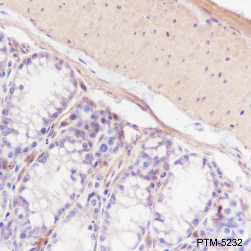 Anti-Calponin 1 Rabbit mAb
