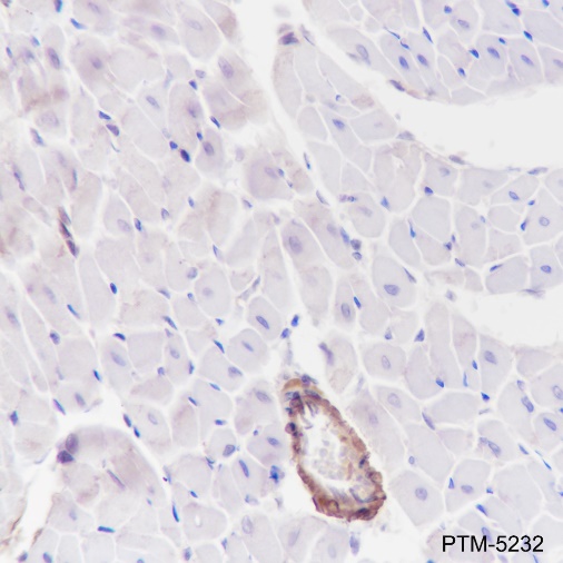 Anti-Calponin 1 Rabbit mAb