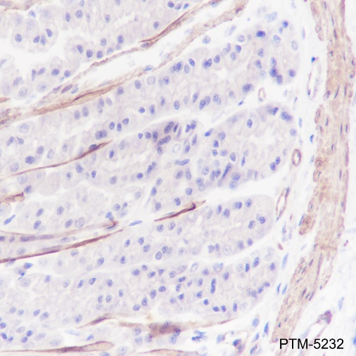 Anti-Calponin 1 Rabbit mAb