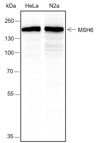 Anti-MSH6 Rabbit mAb
