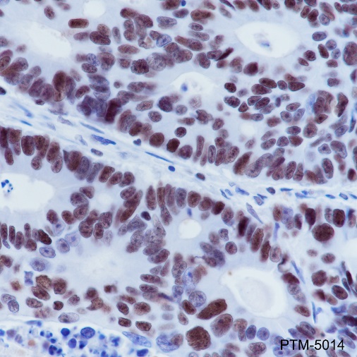 Anti-MSH6 Rabbit mAb