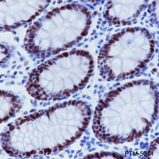 Anti-MSH6 Rabbit mAb
