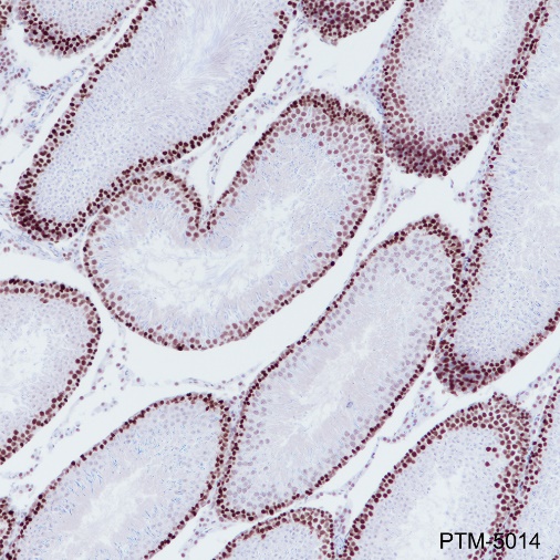 Anti-MSH6 Rabbit mAb