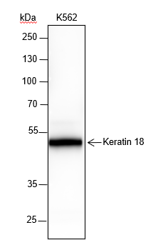 Anti-Keratin 18 Rabbit mAb