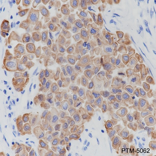 Anti-Keratin 18 Rabbit mAb