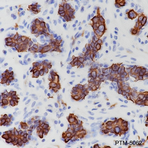 Anti-Keratin 18 Rabbit mAb