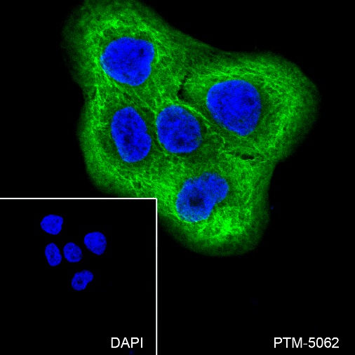 Anti-Keratin 18 Rabbit mAb